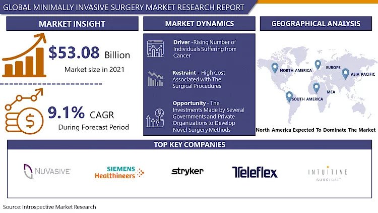 Global Minimally Invasive Surgery Industry Is Expected To Reach USD 97.66 Billion By The Year 2028|Says IMR